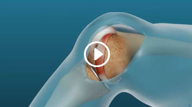 Medical Animation, Corporate Animation